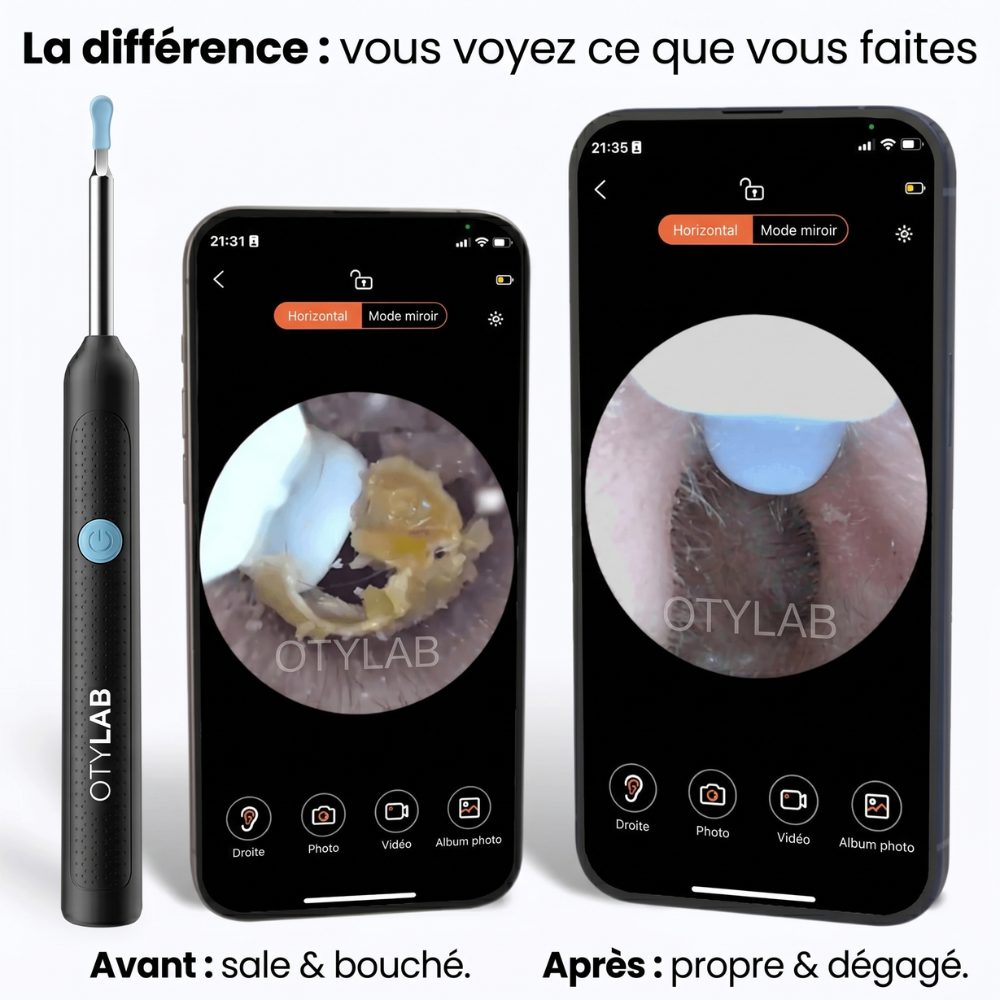 OTYLAB™ Pro — Nettoyeur d'Oreille Visuel à Caméra HD