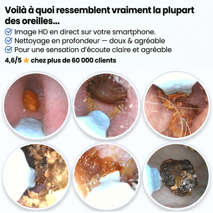 OTYLAB™ Pro — Nettoyeur d'Oreille Visuel à Caméra HD