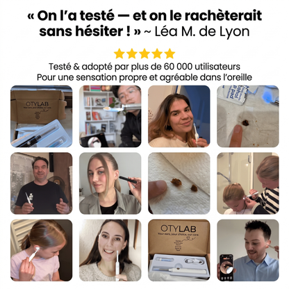 OTYLAB™ Pro — Nettoyeur d'Oreille Visuel à Caméra HD